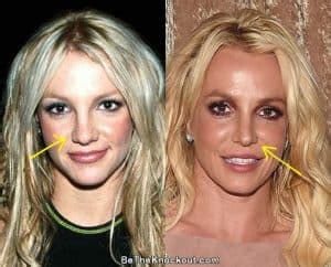 britney spears original nose|Did Britney Spears Get Plastic Surgery Over The。